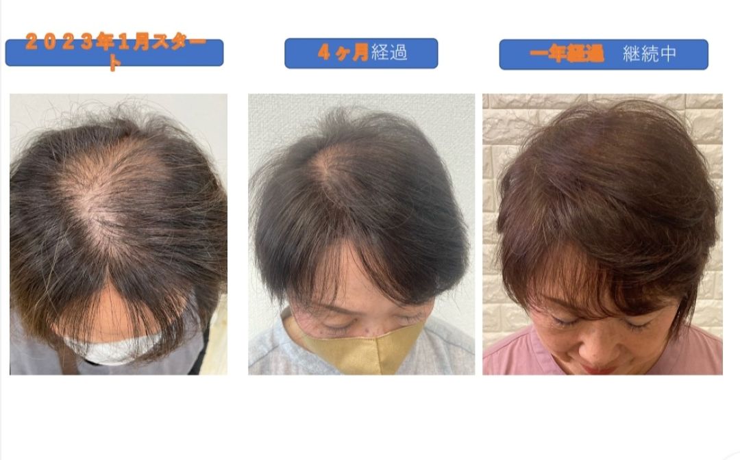 京都唯一の育毛専用ヘッドスパメニュー