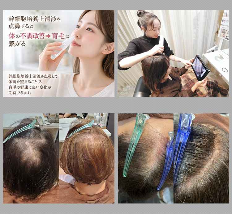 髪質改善 soiris